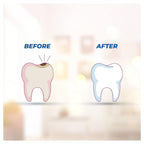 Smyle Herbal Teeth Toothpaste 100gm