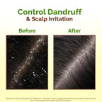 Mamaearth Lemon Anti-Dandruff Hair Oil 100ml