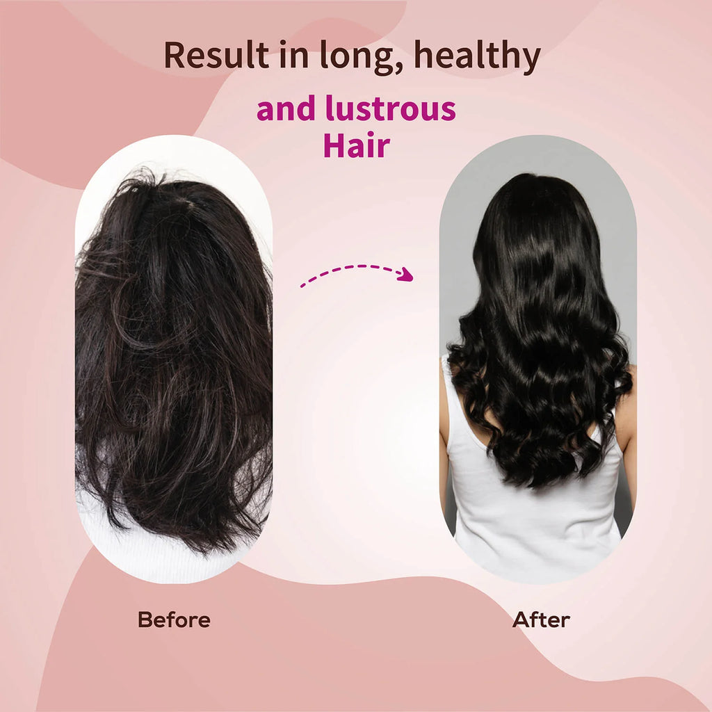 Aimil Ayouthveda Cosmetics Anti Hair Fall Shampoo 200ml