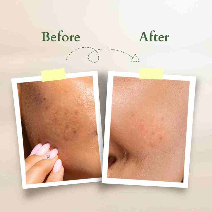 Lotus Organics+ Cosmetics Vit C Radiance Booster Cream SPF-20 50g