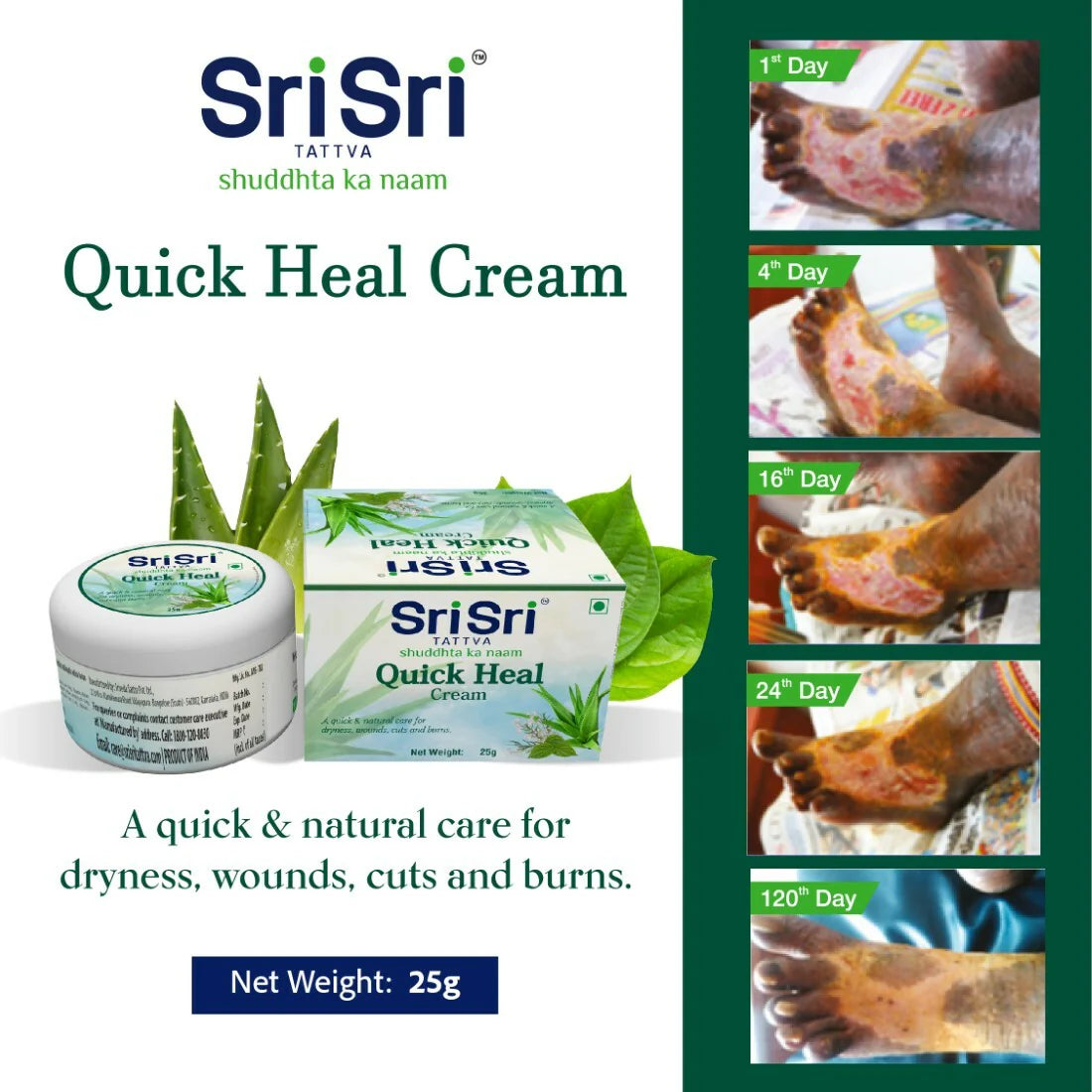 Sri Sri Tattva Ayurvedic Quick Heal Cream